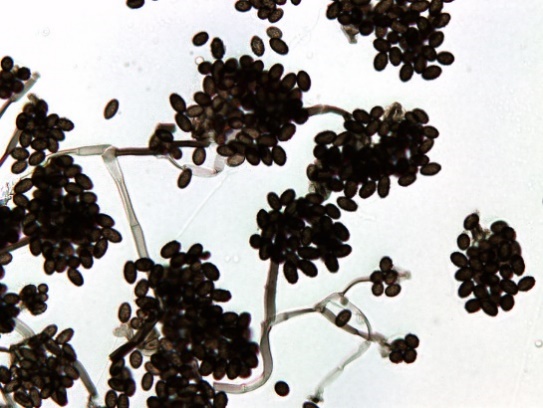 Black mould under a microscope